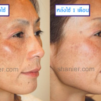 ประโยชน์ของพลาเซนต้า